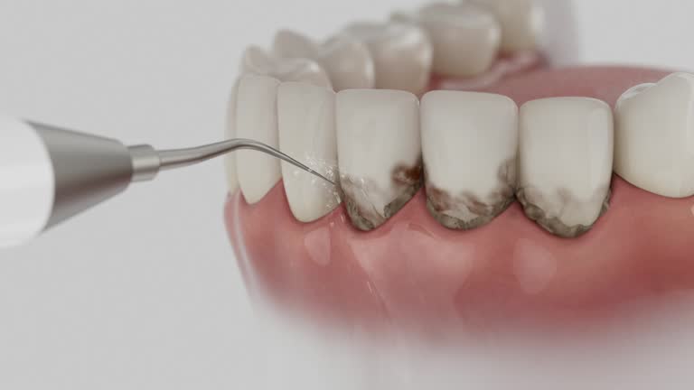 Trusted Teeth Cleaning And Checkup service in Locust Fork, AL - Dentist Open Now